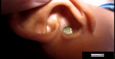 Что это, ухо так болит ...