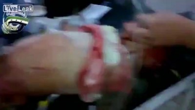 Сирия: раненый ребенок - жертва режима Асада