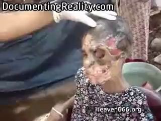 Без половины лица