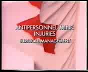 Ранения противопехотными минами.