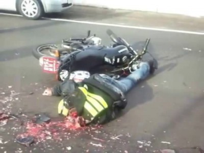 Последствия езды без шлема ...