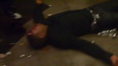 Man Shot in the Head at Night Club in New York