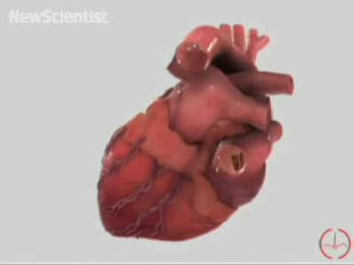 Cверх-реалистичная компьютерная модель сердца