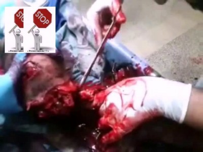 Отрезали ногу ...