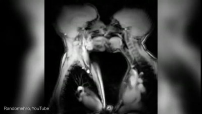 MRI scans take a look at internal organs during sex