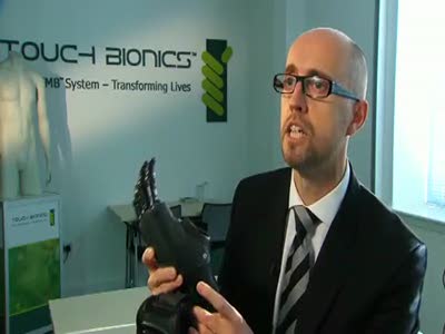 ProDigits: The world's first bionic finger