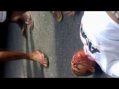 Поцарапал колено ...