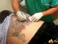 Tattoo Infection