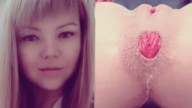 The face of Juicypussy2288 and her anal prolapse